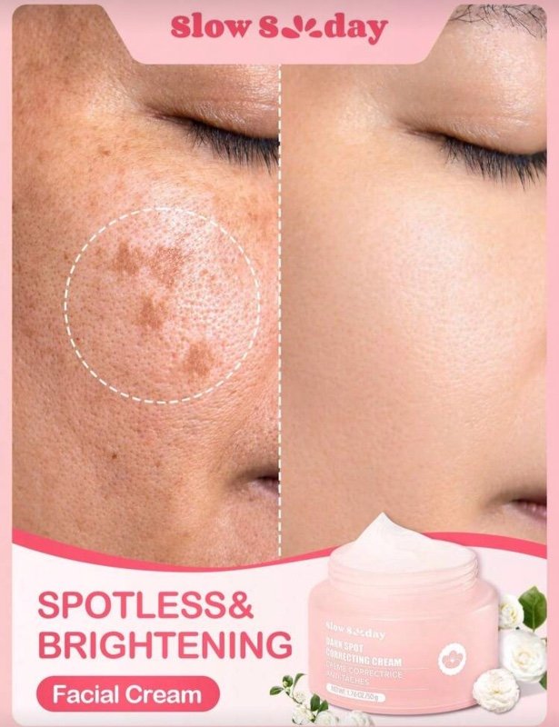 SPOTLESS & BRIGHTENING Facial Cream