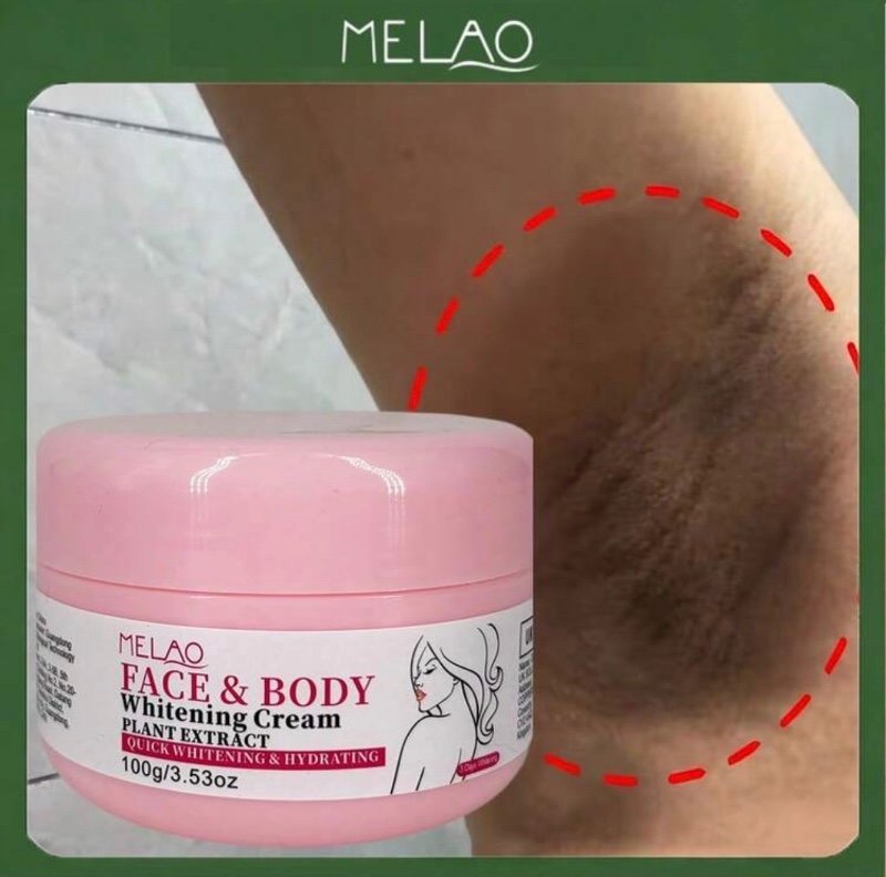 Crème Vergeture