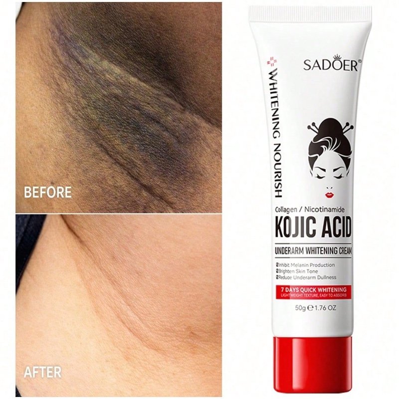 Crème blanchissante pour les aisselles SADOER (1 pièce) : lotion corporelle hydratante et apaisante, riche en niacinamide et en collagène. Elle aide à réduire le noircissement des aisselles, illumine la peau, combat la sécheresse et la rugosité, et resser